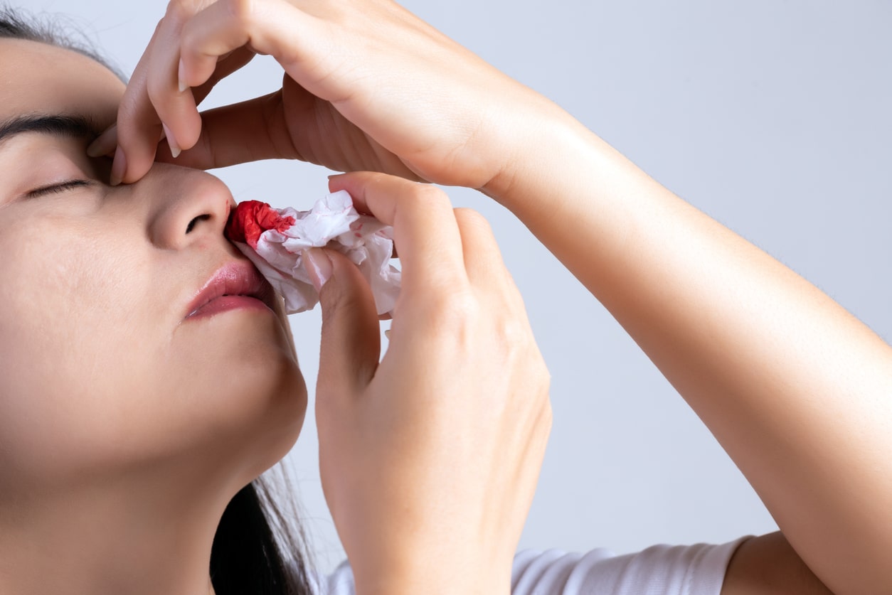 Nosebleed , a young woman with a bloody nose.